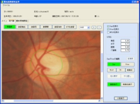 fundus.jpg